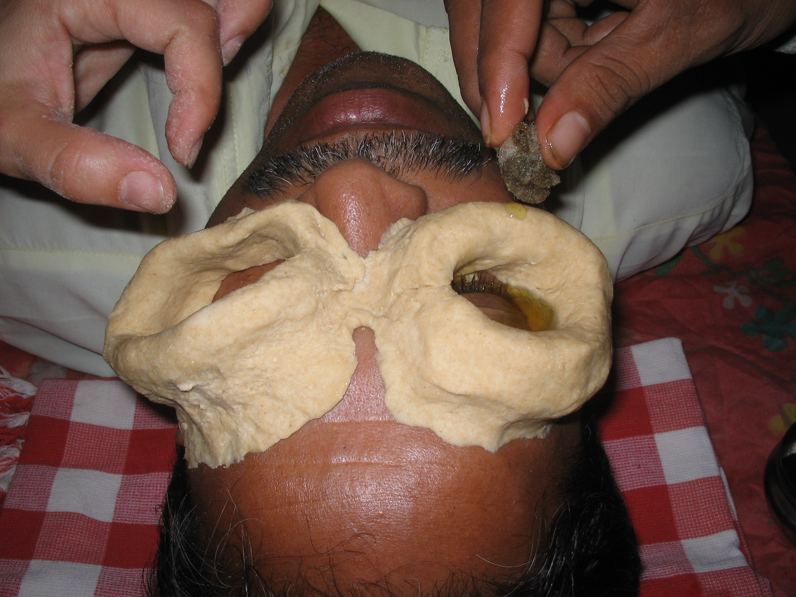 Ayurvedic Eye Treatment